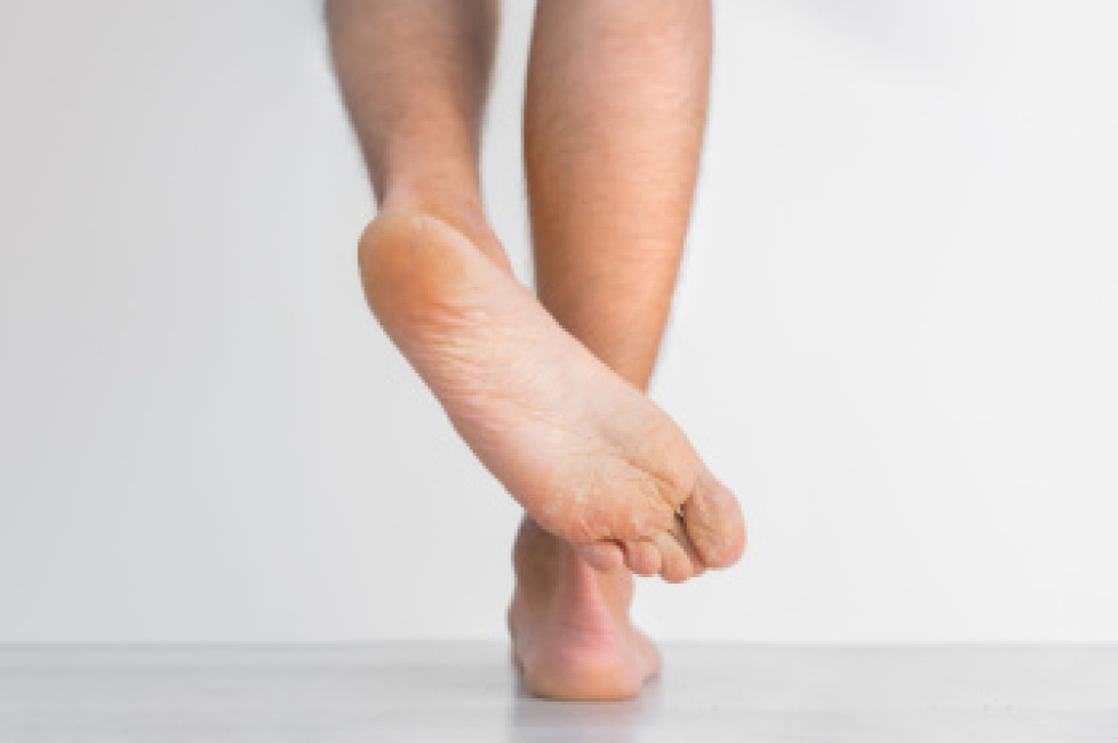Podiatric Care for Athlete’s Foot